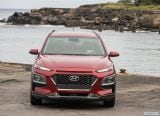 hyundai_2018_kona_us_version_111.jpg