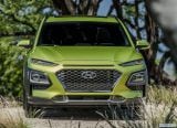 hyundai_2018_kona_us_version_113.jpg
